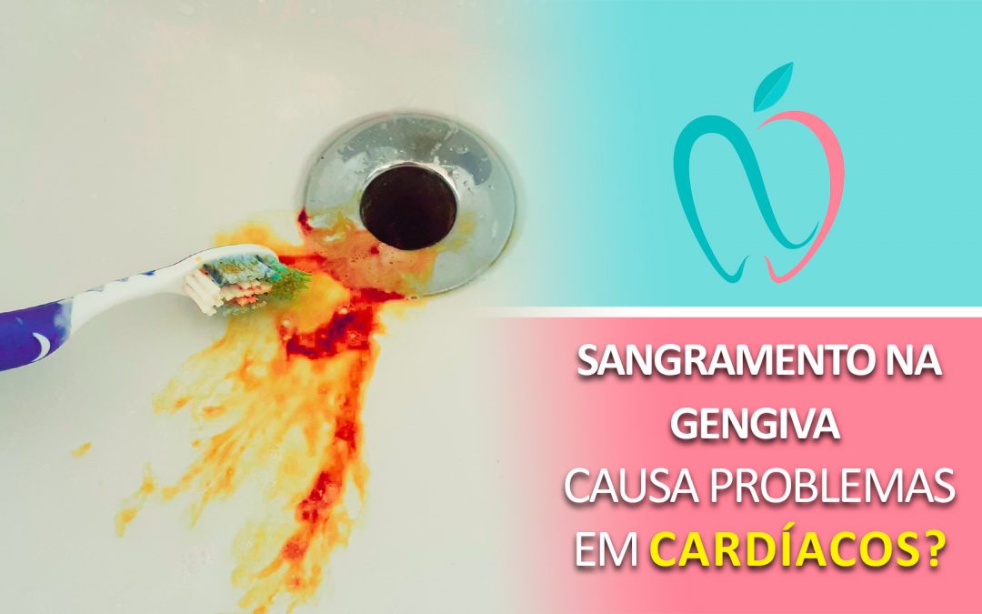 Sangramento na gengiva causa problemas em cardíacos?